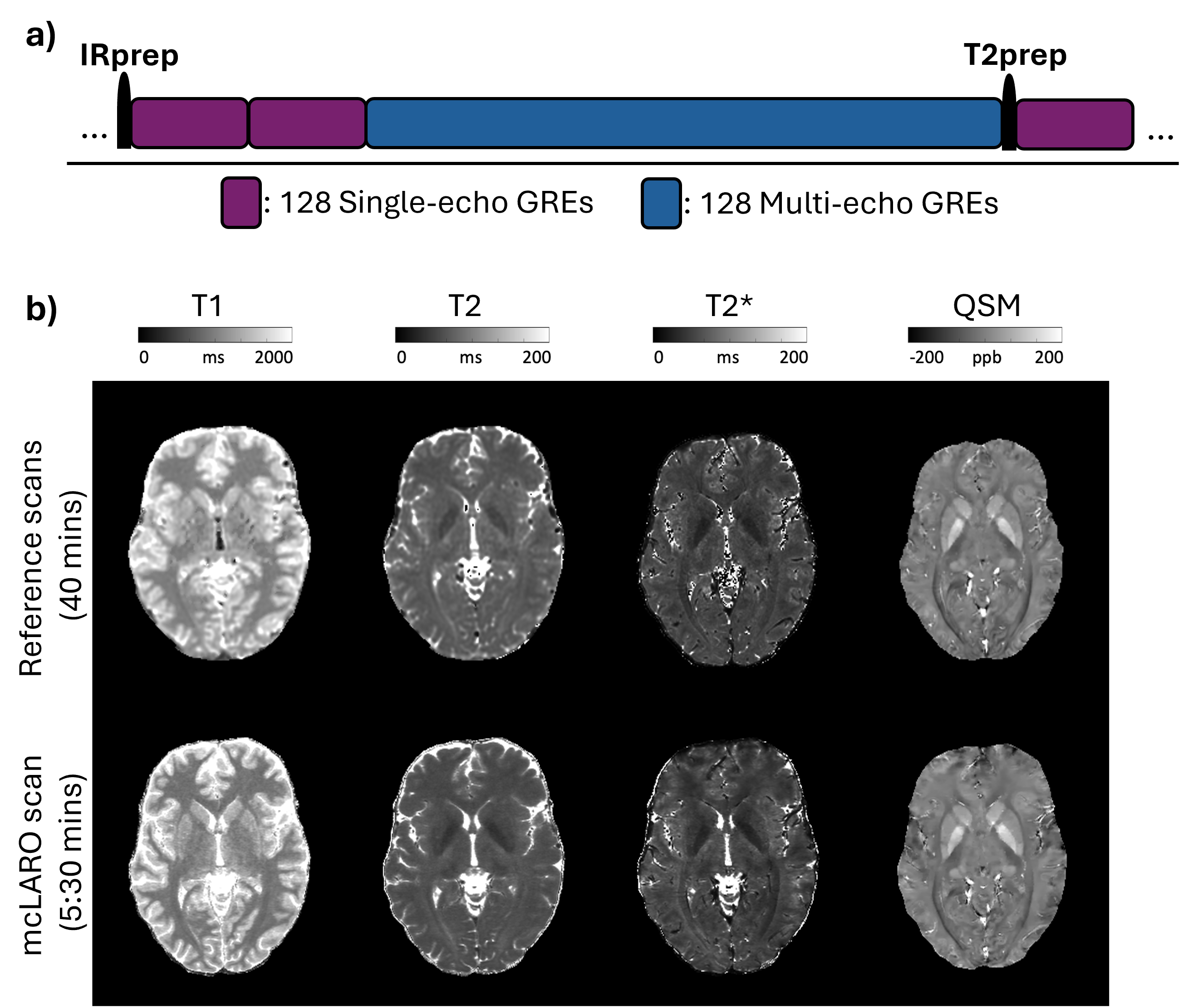 Accelerated MRI research figure