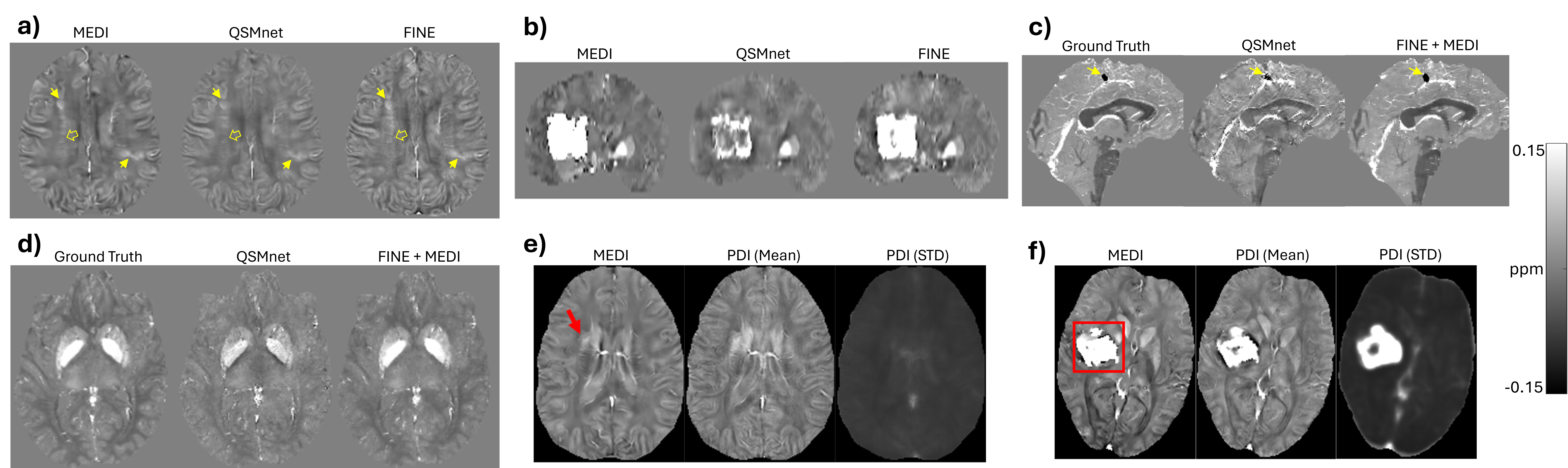 Quantitative tissue parameter mapping research figure
