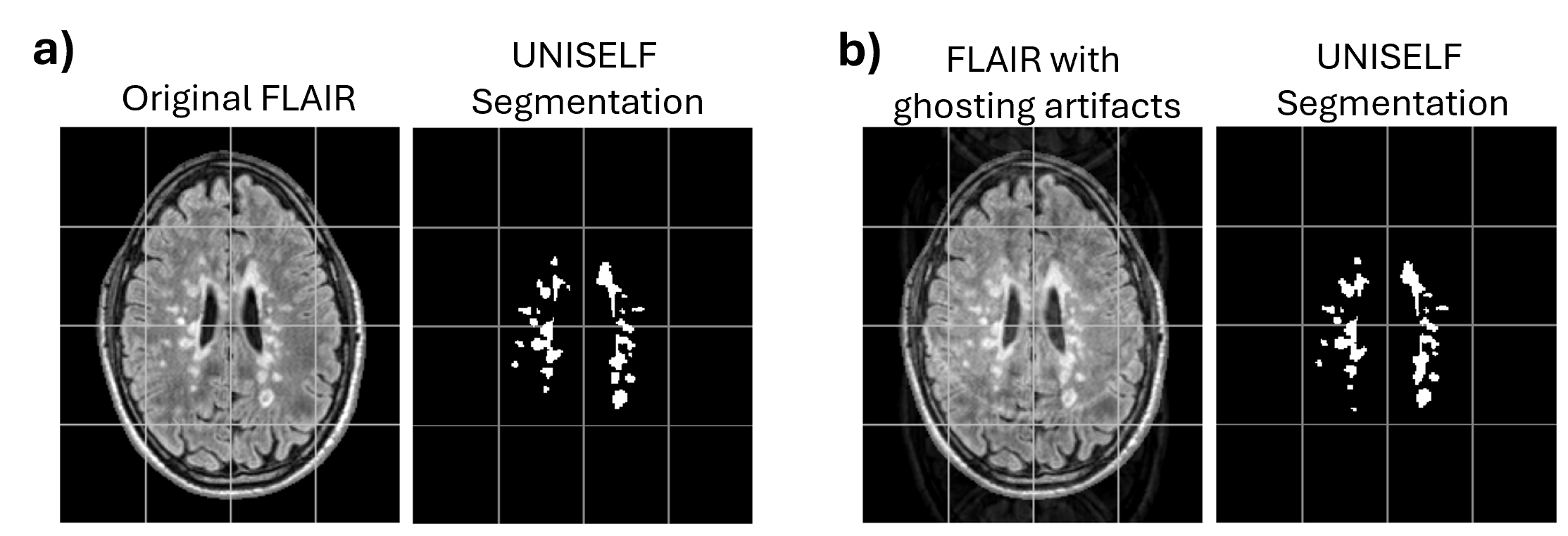 Lesion analysis research figure one
