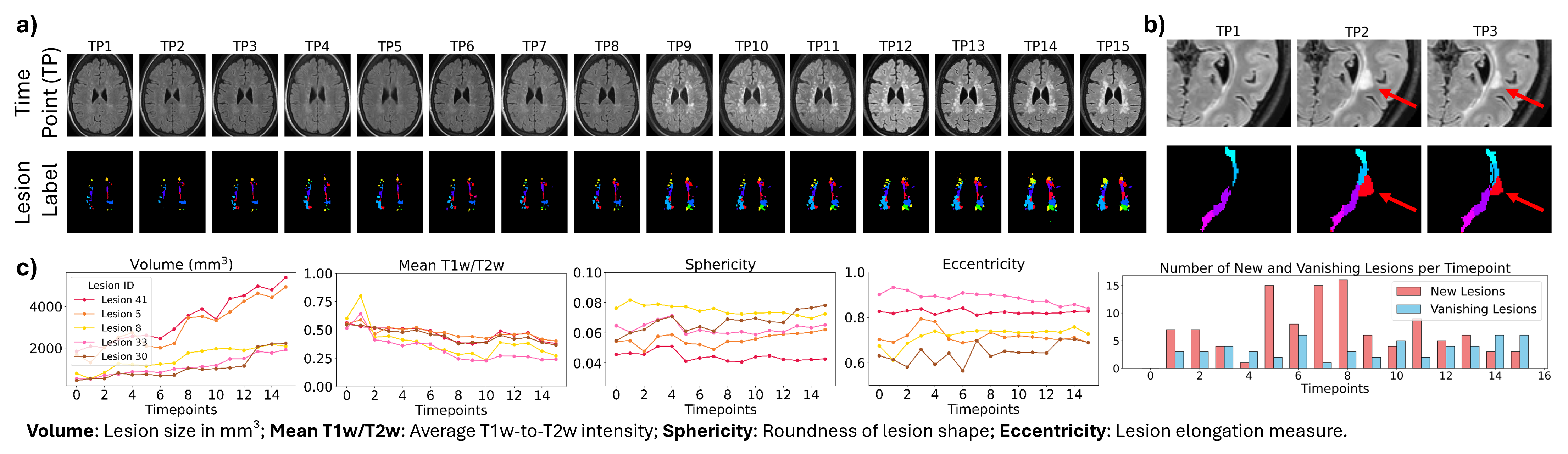 Lesion analysis research figure two